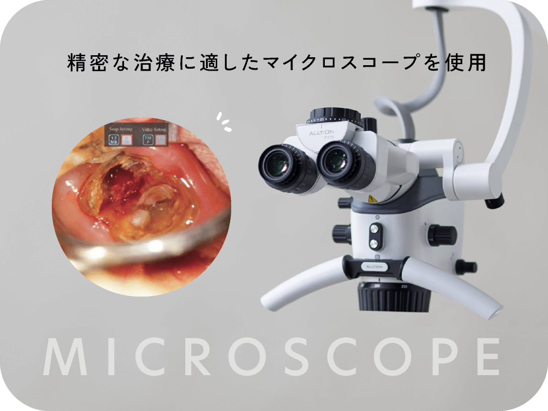 精密な治療に適したマイクロスコープを使用